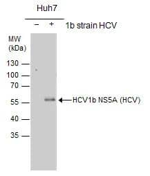 HCV1b NS5A(HCV virus) antibody detects HCV1b NS5A protein by western blot analysis. Non-transfected (-) and HCV1b NS5A-transfected (+) Huh7 whole cell extracts (30ug) were separated by 10% SDS-PAGE, and the membrane was blotted with HCV1b NS5A(HCV virus) antibody (NBP3-48447) at a dilution of 1:1000 