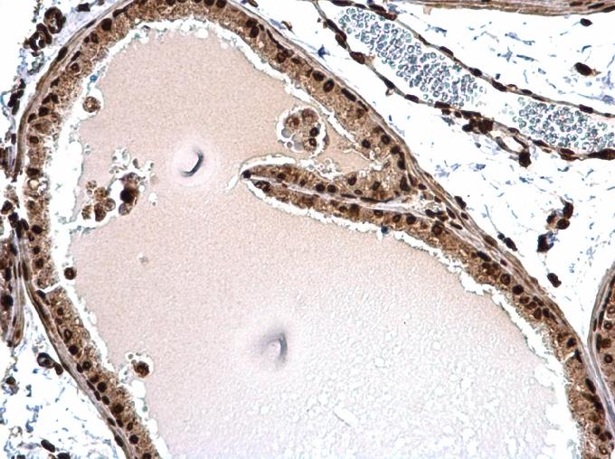 Histone H1.3 antibody detects Histone H1.3 protein at nucleus on mouse prostate by immunohistochemical analysis. Sample: Paraffin-embedded mouse prostate. Histone H1.3 antibody (NBP3-48449) dilution: 1:500. Antigen Retrieval: Trilogy� (EDTA based, pH 8.0) buffer, 15min 