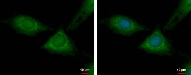 Immunocytochemistry/ Immunofluorescence RPL37 Antibody