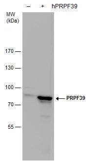 PRPF39 antibody detects PRPF39 protein by western blot analysis. Non-transfected (-) and PRPF39-transfected (+, including Flag-tag) 293T whole cell extracts (30 ug) were separated by 7.5% SDS-PAGE, and the membrane was blotted with PRPF39 antibody (NBP3-48451) diluted by 1:5000. 