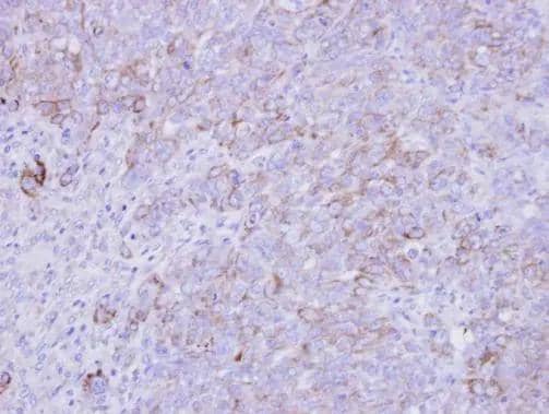 Immunohistochemical analysis of paraffin-embedded DLD-1 xenograft , using SLC26A8(NBP3-48452) antibody at 1:500 dilution. ^[^GTX]br>Antigen Retrieval: Citrate buffer, pH 6.0, 15 min 