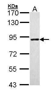 Sample (30 ug of whole cell lysate)  A: Molt-4  7.5% SDS PAGE  NBP3-48452 diluted at 1:1000  