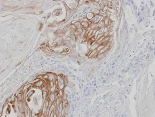 Immunohistochemical analysis of paraffin-embedded SCC25 xenograft, using ZPBP(NBP3-48453) antibody at 1:100 dilution. Antigen Retrieval: (EDTA based, pH 8.0) buffer, 15min 