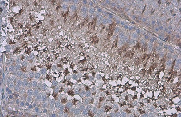 ZPBP antibody detects secreted ZPBP protein by immunohistochemical analysis.Sample: Paraffin-embedded rat testis.ZPBP stained by ZPBP antibody (NBP3-48453) diluted at 1:500.Antigen Retrieval: Citrate buffer, pH 6.0, 15 min 