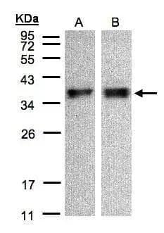 Sample(30 ug of whole cell lysate)A:A431B:HeLa S312% SDS PAGENBP3-48453 diluted at 1:500 