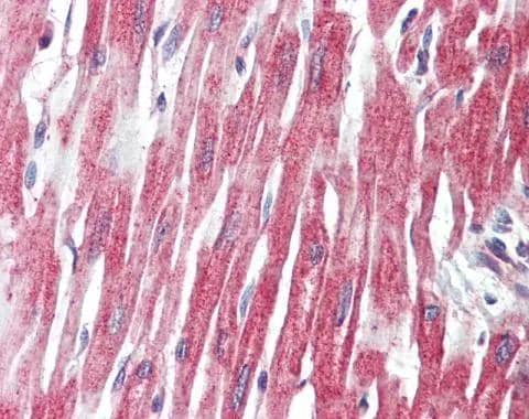 Immunohistochemistry Phospholipase C like 1 Antibody