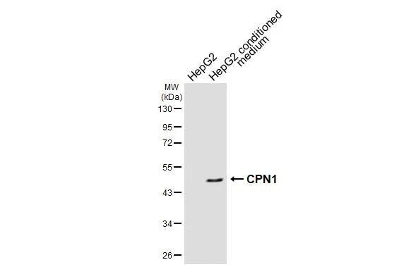 HepG2 whole cell extract and conditioned medium (30 ug) were separated by 10% SDS-PAGE, and the membrane was blotted with CPN1 antibody [N1C3] (NBP3-48455) diluted at 1:1000. The HRP-conjugated anti-rabbit IgG antibody was used to detect the primary antibody. 