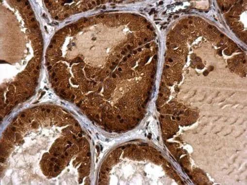 BTG1 antibody detects BTG1 protein at cytosol and nucleus on mouse prostate by immunohistochemical analysis. Sample: Paraffin-embedded mouse prostate. BTG1 antibody (NBP3-48456) dilution: 1:500. Antigen Retrieval: (EDTA based, pH 8.0) buffer, 15min 