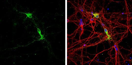 MOG antibody [C2C3], C-term detects MOG protein by immunofluorescent analysis.Sample: DIV9 rat E18 primary cortical neurons and glia cells were fixed in 4% paraformaldehyde at RT for 15 min.Green: MOG protein stained by MOG antibody [C2C3], C-term (NBP3-48458) diluted at 1:500.Red: beta Tubulin 3/ Tuj1, stained by beta Tubulin 3/ Tuj1 antibody [GT886] diluted at 1:500.Blue: Fluoroshield with DAPI . 