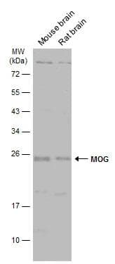 Various tissue extracts (50 ug) were separated by 12% SDS-PAGE, and the membrane was blotted with MOG antibody [C2C3], C-term (NBP3-48458) diluted at 1:1000. The HRP-conjugated anti-rabbit IgG antibody was used to detect the primary antibody. 