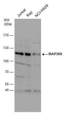 MAP3K9 antibody detects MAP3K9 protein by western blot analysis. Various whole cell extracts (30 ?g) were separated by 7.5% SDS-PAGE, and the membrane was blotted with MAP3K9 antibody (NBP3-48460) diluted by 1:1000. 