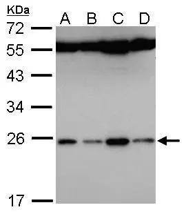 Sample (30 ug of whole cell lysate) A: Hela B: Hep G2 D: Raji 12% SDS PAGE NBP3-48463 diluted at 1:5000  