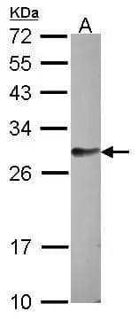 Sample (30 ug of whole cell lysate)  A: HCT116  12% SDS PAGE  NBP3-48464 diluted at 1:1000  