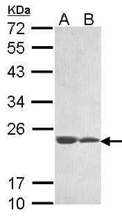 Sample (30 ug of whole cell lysate)  A: 293T  B: A431  12% SDS PAGE  NBP3-48466 diluted at 1:1000  