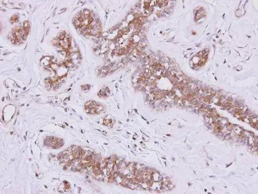 Immunohistochemistry FSD2 Antibody