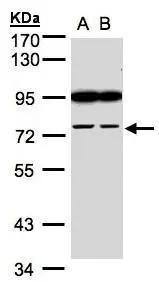Western Blot FSD2 Antibody