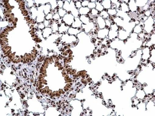 hnRNP H2 antibody detects hnRNP H2 protein at nucleus on mouse lung by immunohistochemical analysis. Sample: Paraffin-embedded mouse lung. hnRNP H2 antibody (NBP3-48468) dilution: 1:500. Antigen Retrieval: (EDTA based, pH 8.0) buffer, 15min 