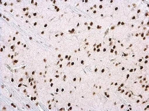 hnRNP H2 antibody detects hnRNP H2 protein at nucleus on rat middle brain by immunohistochemical analysis. Sample: Paraffin-embedded rat middle brain. hnRNP H2 antibody (NBP3-48468) dilution: 1:500. Antigen Retrieval: (EDTA based, pH 8.0) buffer, 15min 