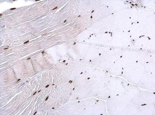 hnRNP H2 antibody detects hnRNP H2 protein at nucleus on mouse lung by immunohistochemical analysis. Sample: Paraffin-embedded mouse lung. hnRNP H2 antibody (NBP3-48468) dilution: 1:500. Antigen Retrieval: (EDTA based, pH 8.0) buffer, 15min 