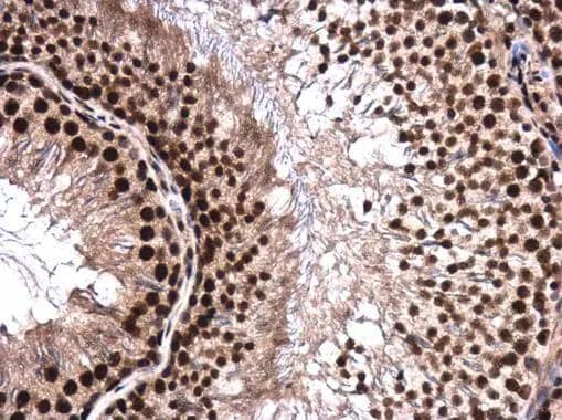 hnRNP H2 antibody detects hnRNP H2 protein at cytoplasm and nucleus in rat testis by immunohistochemical analysis. Sample: Paraffin-embedded rat testis. hnRNP H2 antibody (NBP3-48468) diluted at 1:500. ^[^GTX]br>Antigen Retrieval: Citrate buffer, pH 6.0, 15 min 