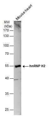 Mouse tissue extract (50 ug) was separated by 10% SDS-PAGE, and the membrane was blotted with hnRNP H2 antibody (NBP3-48468) diluted at 1:500. 