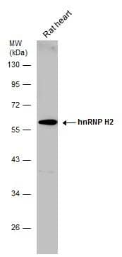Rat tissue extract (50 ug) was separated by 10% SDS-PAGE, and the membrane was blotted with hnRNP H2 antibody (NBP3-48468) diluted at 1:500. 