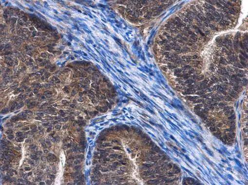 Immunohistochemistry CCDC170 Antibody