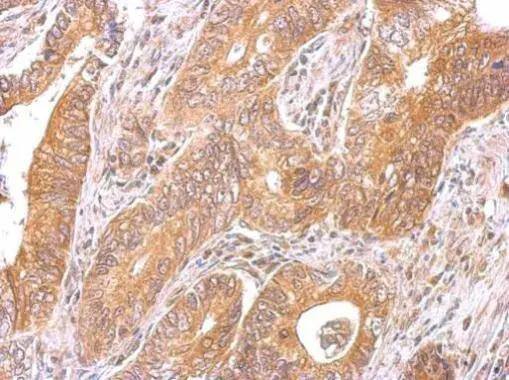 Immunohistochemistry CCDC170 Antibody