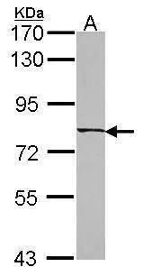 Western Blot CCDC170 Antibody