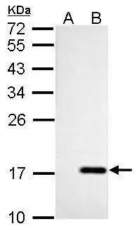 nm23-H4 antibody detects NME4 protein by Western blot analysis.A. 30 ug 293T whole cell lysate/extractB. 30 ug whole cell lysate/extract of human NME4-transfected 293T cells12 % SDS-PAGEnm23-H4 antibody (NBP3-48473) dilution: 1:5000 