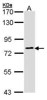 Sample (30 ug of whole cell lysate) A: Hela 7.5% SDS PAGE NBP3-48474 diluted at 1:1000  