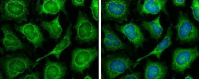 TOMM7 antibody [N1C3] detects TOMM7 protein at mitochondria by immunofluorescent analysis.Sample: HeLa cells were fixed in ice-cold MeOH for 5 min.Green: TOMM7 stained by TOMM7 antibody [N1C3] (NBP3-48475) diluted at 1:500.Blue: Hoechst 33342 staining. 