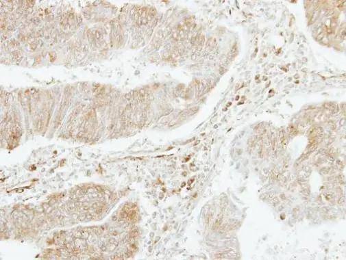 Immunohistochemistry CXCL4L1 Antibody