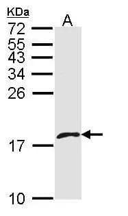 Western Blot CXCL4L1 Antibody