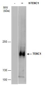 TENC1 antibody detects TENC1 protein by western blot analysis.293T mock transfected (-) or transfected with a construct expressing human TENC1 (+).5 % SDS-PAGETENC1 antibody (NBP3-48480) dilution: 1:5000 