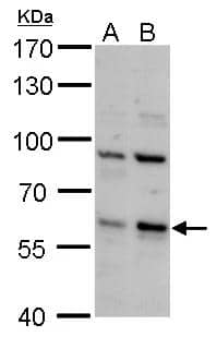 Western Blot PCTAIRE2 Antibody