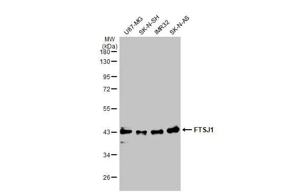 Various extracts (30 ug) were separated by 10% SDS-PAGE, and the membrane was blotted with FTSJ1 antibody (NBP3-48484) diluted at 1:15000. The HRP-conjugated anti-rabbit IgG antibody was used to detect the primary antibody, and the signal was developed with Trident ECL plus-Enhanced. 