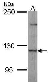 Western Blot Puratrophin-1 Antibody