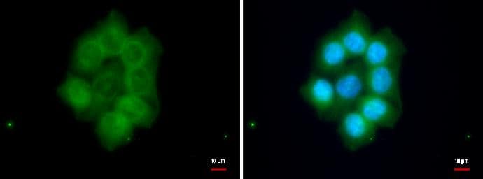 Immunocytochemistry/ Immunofluorescence FAM46C Antibody