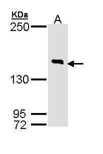 Sample (30 ug of whole cell lysate) A: Hela 7.5% SDS PAGE NBP3-48489 diluted at 1:1000 
