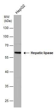 LIPC antibody [N1C1] detects LIPC [N1C1] protein by western blot analysis. Whole cell extracts (30 ug) was separated by 10% SDS-PAGE, and the membrane was blotted with LIPC antibody [N1C1] (NBP3-48490) diluted at 1:500. 