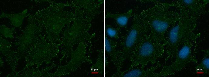 AOC2 antibody detects AOC2 protein at membrane by immunofluorescent analysis.Sample: HeLa cells were fixed in ice-cold MeOH for 5 min.Green: AOC2 protein stained by AOC2 antibody (NBP3-48495) diluted at 1:500.Blue: Hoechst 33342 staining. 