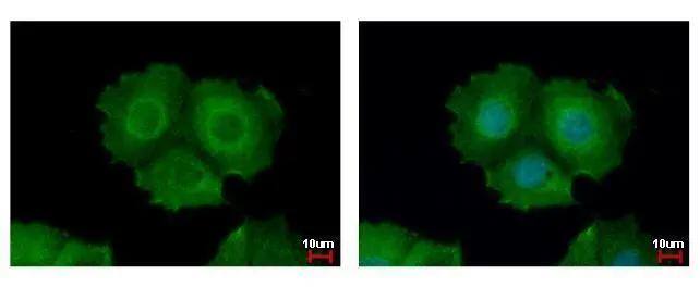 Immunocytochemistry/ Immunofluorescence Keratin 31 Antibody