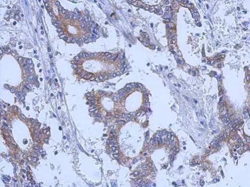Immunohistochemistry Keratin 31 Antibody