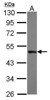 Western Blot Keratin 31 Antibody