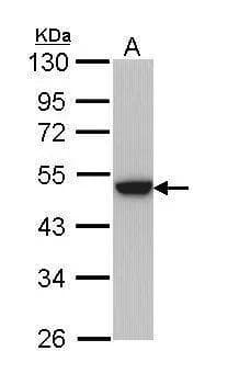 Sample (30 ug of whole cell lysate)  A: Hela  10% SDS PAGE  NBP3-48497 diluted at 1:1000  