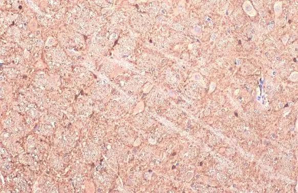 GAD1/GAD67 antibody detects GAD1/GAD67 protein at cell membrane and cytoplasm by immunohistochemical analysis.Sample: Paraffin-embedded rat brain.GAD1/GAD67 stained by GAD1/GAD67 antibody (NBP3-48499) diluted at 1:50.Antigen Retrieval: Citrate buffer, pH 6.0, 15 min 