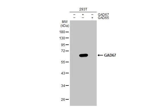 Non-transfected (�) and transfected (+) 293T whole cell extracts (30 �g) were separated by 10% SDS-PAGE, and the membrane was blotted with GAD1/GAD67 antibody (NBP3-48499) diluted at 1:5000. The HRP-conjugated anti-rabbit IgG antibody was used to detect the primary antibody. 