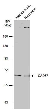 Various tissue extracts (50 ?g) were separated by 7.5% SDS-PAGE, and the membrane was blotted with GAD1/GAD67 antibody (NBP3-48499) diluted at 1:500. The HRP-conjugated anti-rabbit IgG antibody was used to detect the primary antibody, and the signal was developed with Trident ECL plus-Enhanced. 