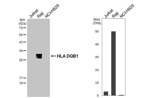 Various whole cell extracts (30 ug) were separated by 12% SDS-PAGE, and the membrane was blotted with HLA DQB1 antibody (NBP3-48501) diluted at 1:1000. The HRP-conjugated anti-rabbit IgG antibody was used to detect the primary antibody. Corresponding RNA expression data for the same cell lines are based on Human Protein Atlas program. 